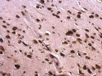 SAFB Antibody in Immunohistochemistry (Paraffin) (IHC (P))