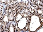 PAX8 Antibody in Immunohistochemistry (Paraffin) (IHC (P))