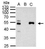 PAX8 Antibody in Immunoprecipitation (IP)