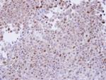 PSMA7 Antibody in Immunohistochemistry (Paraffin) (IHC (P))