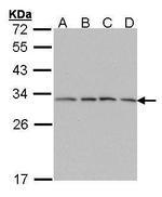 PSMA7 Antibody in Western Blot (WB)