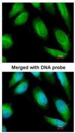 Creatine Kinase BB Antibody in Immunocytochemistry (ICC/IF)