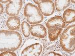 ENO1 Antibody in Immunohistochemistry (Paraffin) (IHC (P))