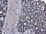 RPS10 Antibody in Immunohistochemistry (Paraffin) (IHC (P))