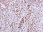 RPS10 Antibody in Immunohistochemistry (Paraffin) (IHC (P))