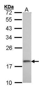 RPS10 Antibody in Western Blot (WB)