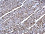 UQCRC1 Antibody in Immunohistochemistry (Paraffin) (IHC (P))