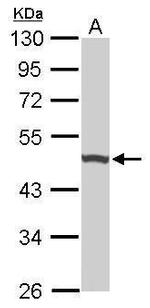 UQCRC1 Antibody in Western Blot (WB)