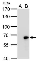 GAD67 Antibody in Western Blot (WB)