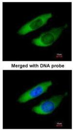 ARPC2 Antibody in Immunocytochemistry (ICC/IF)