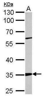 ARPC2 Antibody in Western Blot (WB)