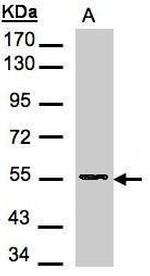 DNPEP Antibody in Western Blot (WB)