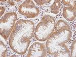 DIAPH1 Antibody in Immunohistochemistry (Paraffin) (IHC (P))