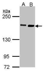 DIAPH1 Antibody in Western Blot (WB)