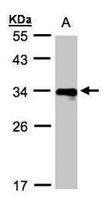 HLA-DR beta Antibody in Western Blot (WB)