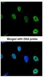 TAP Antibody in Immunocytochemistry (ICC/IF)