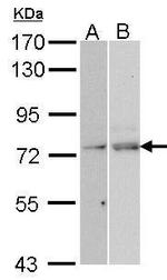 TAP Antibody in Western Blot (WB)