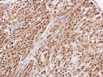 EFCAB14 Antibody in Immunohistochemistry (Paraffin) (IHC (P))