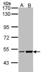 EFCAB14 Antibody in Western Blot (WB)