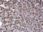 NDUFV1 Antibody in Immunohistochemistry (Paraffin) (IHC (P))