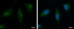 PRKD2 Antibody in Immunocytochemistry (ICC/IF)