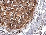 PRKD2 Antibody in Immunohistochemistry (Paraffin) (IHC (P))