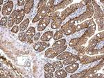 PRKD2 Antibody in Immunohistochemistry (Paraffin) (IHC (P))