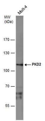 PRKD2 Antibody in Western Blot (WB)