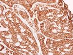 GANAB Antibody in Immunohistochemistry (Paraffin) (IHC (P))