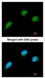 CtBP2 Antibody in Immunocytochemistry (ICC/IF)