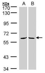 MPP3 Antibody in Western Blot (WB)