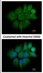 Cytokeratin 2e Antibody in Immunocytochemistry (ICC/IF)