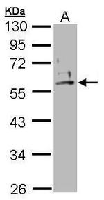 Cytokeratin 2e Antibody in Western Blot (WB)