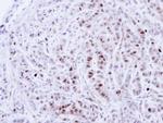 NEK4 Antibody in Immunohistochemistry (Paraffin) (IHC (P))