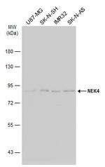 NEK4 Antibody in Western Blot (WB)