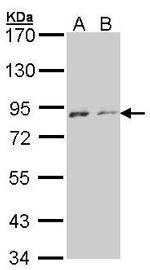 NEK4 Antibody in Western Blot (WB)