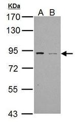 PDE4B Antibody in Western Blot (WB)