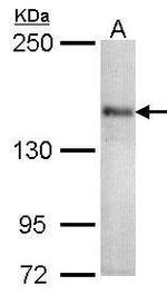 CaV1.1 Antibody in Western Blot (WB)