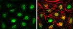 CAS Antibody in Immunocytochemistry (ICC/IF)