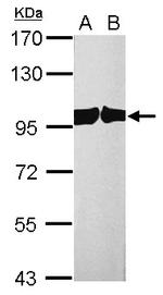 CAS Antibody in Western Blot (WB)