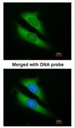 ATIC Antibody in Immunocytochemistry (ICC/IF)