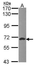 ATIC Antibody in Western Blot (WB)