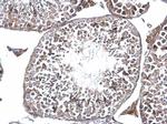 DMC1 Antibody in Immunohistochemistry (Paraffin) (IHC (P))