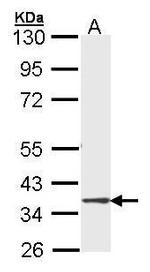 DMC1 Antibody in Western Blot (WB)