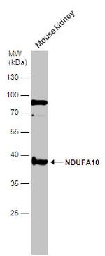 NDUFA10 Antibody in Western Blot (WB)