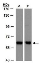 COPD Antibody in Western Blot (WB)