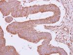 RhoGAP4 Antibody in Immunohistochemistry (Paraffin) (IHC (P))