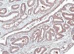 HOMER1 Antibody in Immunohistochemistry (Paraffin) (IHC (P))