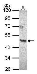 ACAD8 Antibody in Western Blot (WB)