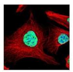 SART1 Antibody in Immunocytochemistry (ICC/IF)